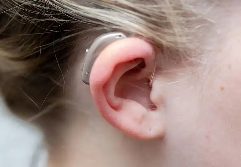 Hearing Aids